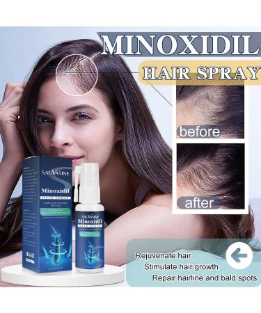 Buy 5% Minoxidil Hair Growth Spray for Men & Women | Anti Hair Loss Treatment | 2 Month Supply | Extra Strength Scalp Solution for Thicker Stronger Hair - Buy Online on SooperMarket.com