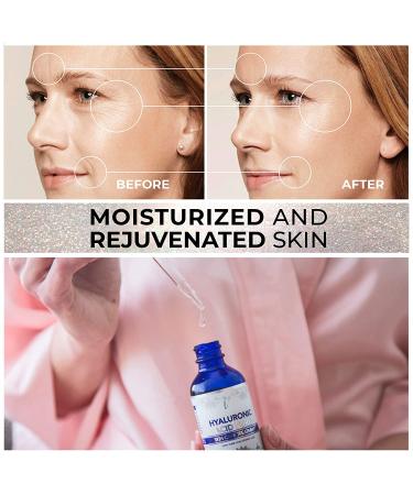 Hydrating Hyaluronic Acid Serum for Face and Lips (2 Oz) - Medical Grade Formula for All Skin Types - Paraben and Fragrance-Free - Buy Online on SooperMarket.com