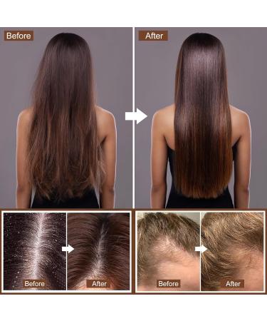 Ginger Hair Growth Shampoo Bar & Conditioner Set | Natural Anti Hair Loss PH Balanced Silicone-Free | Boost Hair Regrowth - Buy Online on SooperMarket.com