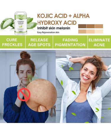 Skin Brightening Serum with Kojic Acid - Dark Spot Corrector for Face & Body - Fade Hyperpigmentation & Melasma - 1 oz (Pack of 2) - Buy Online on SooperMarket.com