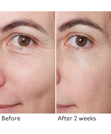 By Terry Hyaluronic Global Face Serum - Reduces Wrinkles & Fine Lines Vegan Fragrance-Free All Skin Types - 1.1 fl oz | International Shipping Available - Buy Online on SooperMarket.com