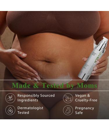 Abera Ovela Maternity Stretch Mark Cream - Effective Treatment for Pregnancy & Weight Fluctuations Deep Mark Removal All Skin Types 1.69 fl oz - Buy Online on SooperMarket.com