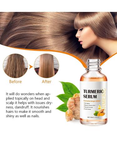 Turmeric Dark Spot Corrector Serum for Women - Anti-Aging Face Serum with Curcuma Longa - Even Skin Tone, Remove Dark Spots & Age Spots - Daily Skin Care Solution - Buy Online on SooperMarket.com