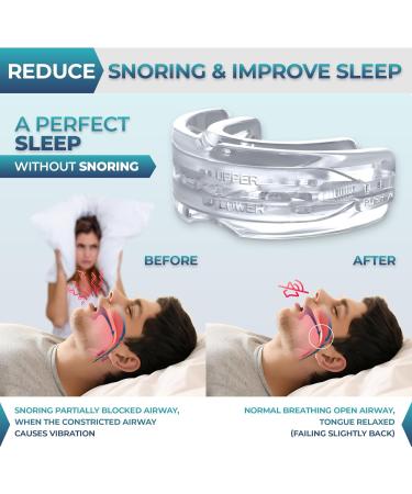 Anti Snoring Devices Anti Snoring Mouth Guard and Chin Straps for Snoring Stop Snoring Devices Effective Snoring Solution Anti-Snoring Mouthpiece and Chin Straps for Men and Women to Stop Snoring - Buy Online on SooperMarket.com