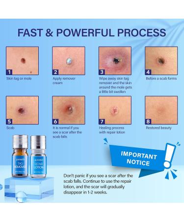 Pureskin Skin Tag Remover & Mole Corrector And Repair Lotion Set Remove Tags and Moles Effortlessly - Buy Online on SooperMarket.com