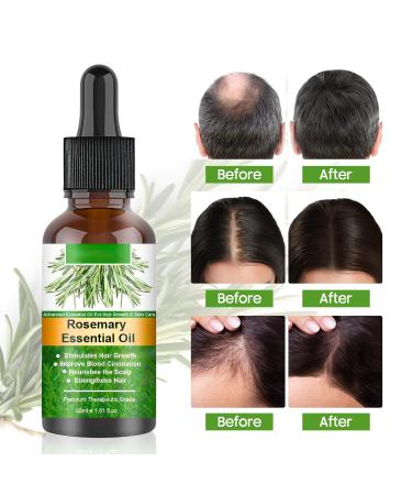 100% Pure Natural Rosemary Oil - Multipurpose Hair Oil for Growth Nourishing Scalp & Strengthening Hair - Buy Online on SooperMarket.com