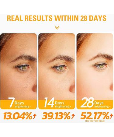 Trendyfave 20% Vitamin C Serum For Face Vitamin C Serum With Hyaluronic Acid Vit C Serum Face Hydrating Face Serum Hydrating & Plump Skin 2FL.OZ - Buy Online on SooperMarket.com