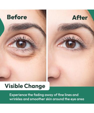 Vivo Per Lei Vitamin C Eye Cream - Anti-Aging Retinol & Peptide Formula for Puffiness Wrinkles & Dark Circles - 1.7 Fl. Oz - Buy Online on SooperMarket.com