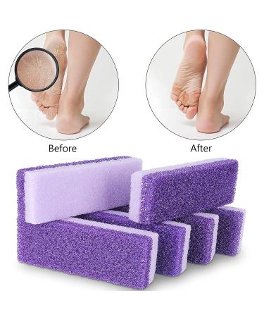 Pumice Stone 6 Pack Foot Scrubber & Callus Remover - Dead Skin Remover for Feet, Heels, Hands and Body - Purple - Buy Online on SooperMarket.com