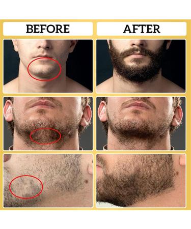 Best Beard Oil for Men | 30ml Organic Growth & Care | Soften & Moisturize Your Beard - Buy Online on SooperMarket.com