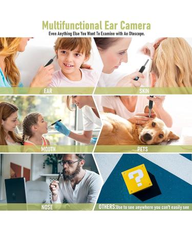 Smart Wireless Ear Wax Removal Tool Camera | Visual Ear Cleaner Kit for Babies, Kids, Adults, Pets | 1296P Ear Otoscope Scope with Cleaning Tool - Buy Online on SooperMarket.com