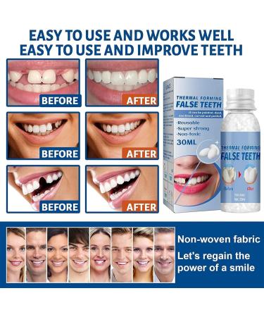 Wttfc Temporary Tooth Repair Kit 60g Tooth Filling Thermal Beads for Instant Veneers & Broken Tooth Repair - Easy Fix Moulding & Replacement - Buy Online on SooperMarket.com