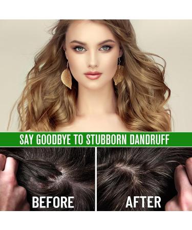 Buy 100% Pure Batana Oil for Hair Growth - Natural & Raw for Thicker Stronger Hair | 2.02 FL OZ | Ships Internationally - Buy Online on SooperMarket.com