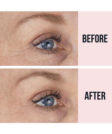 SiO Beauty Super EyeLift | Anti-Wrinkle Silicone Patches - 2 Week Supply - Buy Online on SooperMarket.com