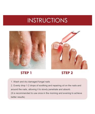 Top Nail Fungus Treatment: German ToenailPlus Kaluofan & More Effective Anti Paronychia Relief & Nail Care - Buy Online on SooperMarket.com