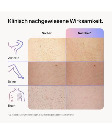 Buy Braun Smart IPL Skin I - Expert Home Hair Removal Kit with App Storage Bag Venus Razor & 4 Attachments - Buy Online on SooperMarket.com