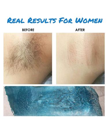 Waxing Kit for Women and Men with Strongest Blue Refill Hard Wax - At-Home Hair Removal for Underarms, Legs, Back, and Chest - Stripless Wax Warmer - Coarse Body Hair Removal - Buy Online on SooperMarket.com