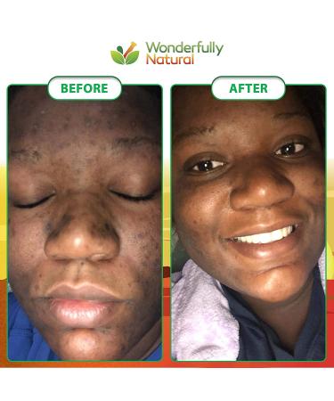 Organic African Black Soap 1lb Bar for Acne & Dark Spots | Face & Body Treatment | 60-Day Guarantee - Buy Online on SooperMarket.com