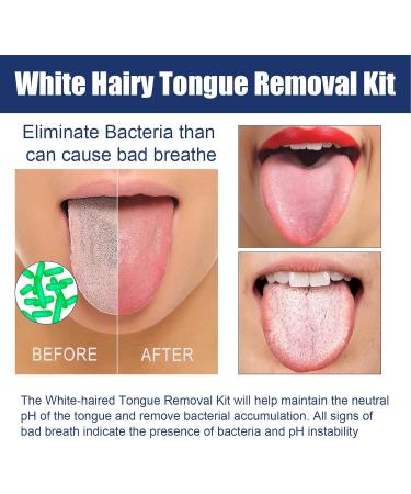 Buy Tongue Scraper Cleaning Brush Set - 2pcs Oral Freshener for Bad Breath Removal | 50g - International Shipping - Buy Online on SooperMarket.com
