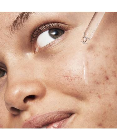 e.l.f. SKIN Blemish Breakthrough Triple-Acid Resurfacing Serum - Hydrating Night Serum with Niacinamide for Acne - Vegan & Cruelty-Free - Buy Online on SooperMarket.com