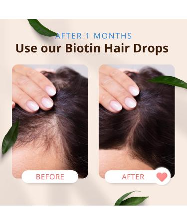 Morfose Biotin Hair Drop - Nourishing Hair Care for Growth & Strength | All Hair Types | 3.38 Fl Oz - Buy Online on SooperMarket.com