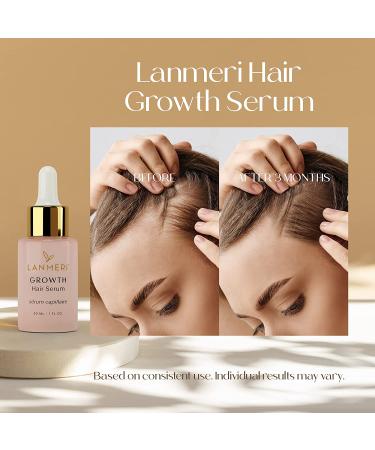 Lanmeri Vegan Hair Growth Serum - Natural Treatment for Hair Loss - Fuller, Thicker Hair in 90 Days - For Women & Men - Buy Online on SooperMarket.com