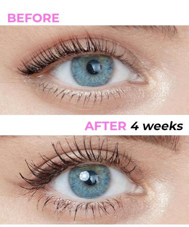 Stacy Lash Growth Serum | Eyelash Enhancing Serum for Longer Thicker Lashes & Brows | International Shipping Available | 0.17fl.oz (5ml - Buy Online on SooperMarket.com