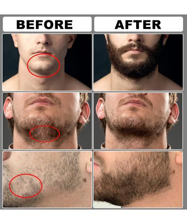Complete Beard Growth Kit for Men - Beard Roller, Wash, Serum, Oil, Balm, Brush, Comb, Scissor, eBook - Perfect Beard Grooming and Care Gift Set - Buy Online on SooperMarket.com