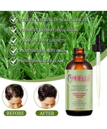 Rosemary Oil for Hair Growth - Organic Essential Oil for Hair Loss Treatment (2 Pieces) - Buy Online on SooperMarket.com