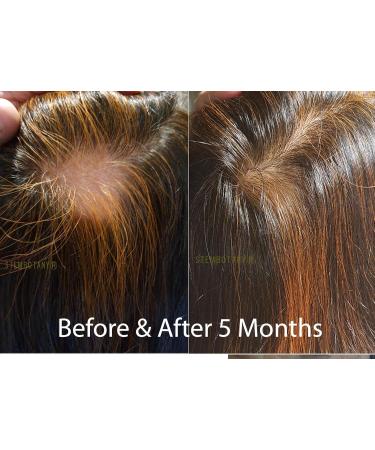 GHK-cu Copper Peptide Hair Regrowth Shampoo for Men & Women - Boost Hair Growth Nourish & Revitalize Shop Internationally - Buy Online on SooperMarket.com