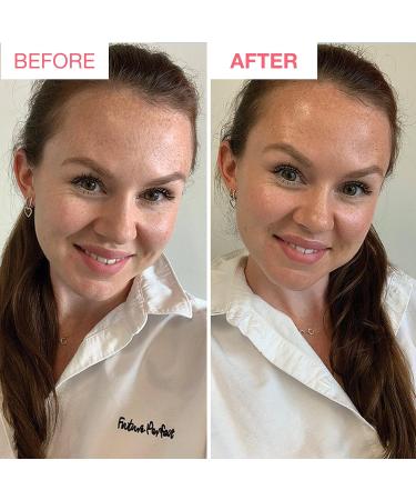 Bare by Vogue Self Tan Face Mist Spray - Light Tan for a Natural Glow on Face & Body - Buy Online on SooperMarket.com