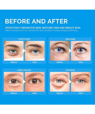 Enaskin Naturals 24K Gold Under Eye Patches for Puffy Eyes & Dark Circles - Under Eye Treatment for Women and Men - Reduce Wrinkles and Eye Bags (Blue) - Buy Online on SooperMarket.com