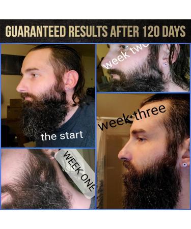 Voxtr Beard Growth Serum - Thicker & Healthier Beard with Follicle Acceleration - 1.69 Fl. Oz - International Shipping Available - Buy Online on SooperMarket.com