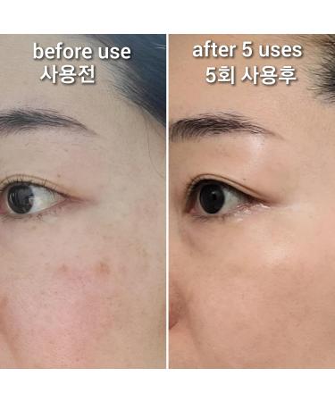 Hydrogen Dual Skin Changer Set | Hydrating Anti-Aging K-Beauty Therapy | International Shipping - Buy Online on SooperMarket.com