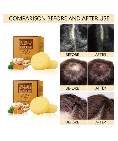 Tamoskiny Ginger & Turmeric Hair Regrowth Shampoo Bar - Organic Solid Bar for Hair Growth 120g - Buy Online on SooperMarket.com