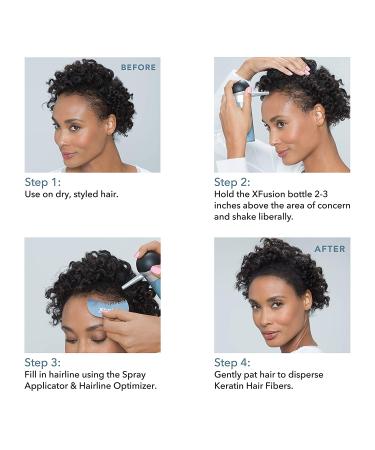 XFusion Keratin Hair Fibers Gray - 15g Medium Brown - Buy Online on SooperMarket.com