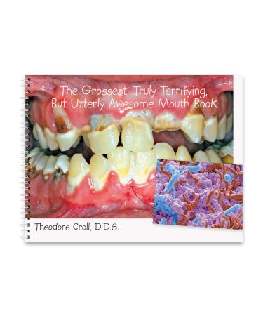 Practicon 8010836 Grossest Truly Terrifying But Utterly Awesome Mouth Book