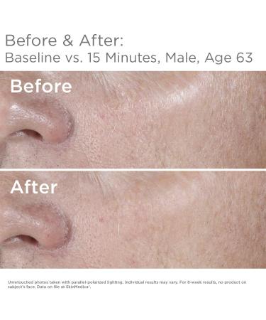 SkinMedica HA5 Rejuvenating Hydrator 2 Oz - Advanced Hyaluronic Acid Serum - Buy Online on SooperMarket.com