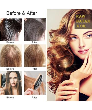 Dr. Sebi Batana Oil - 100% Pure Hair Growth Oil | Unrefined Hair Loss Prevention & Thickness Enhancer for Men & Women | 4.23 OZ - Buy Online on SooperMarket.com
