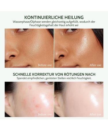 Aloe Vera Gel Moisturising Cream for Face Body Pimples Dry Skin After Sun Sunburn Hair Gel After Sun - Buy Online on SooperMarket.com