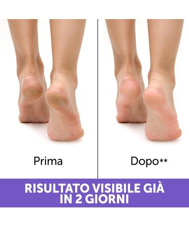Podovis C/Talloni Screpolati 75 ml - Healing Cream for Cracked Heels | International Shipping Available - Buy Online on SooperMarket.com