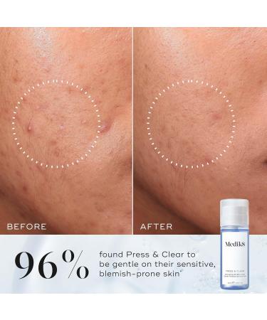 Medik8 Press & Clear - Exfoliating 2% BHA Clarifying Toner - Salicylic & Tranexamic Acid - Reduces Blemishes Blackheads & Oiliness - 150ml - Buy Online on SooperMarket.com