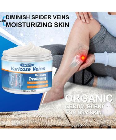 Varicose Veins Cream - Effective Treatment for Leg Relief, Phlebitis & Circulation Improvement (1.7 Fl Oz) - Buy Online on SooperMarket.com
