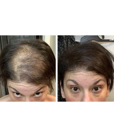 Dark Brown Hair Loss Concealer Trial Size - Cover Bald Spots Instantly - 10-Day Supply - All-Natural Fiber Formula - Buy Online on SooperMarket.com