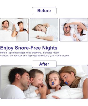 Mouth Tape for Sleeping - 60 Strips | Snoring Aid for Nasal Breathing | Anti-Snoring Myotape for Improved Sleep Quality - Blue - Buy Online on SooperMarket.com