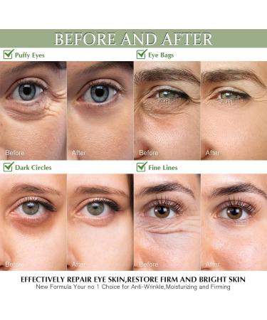 Shefave Eye Pads 60 Pieces Eye Pads Against Dark Circles Green Tea Matcha Eye Pads Hyaluronic Acid Eye Mask Dark Circles Removal Against Wrinkles Eye Bags Puffiness - Buy Online on SooperMarket.com