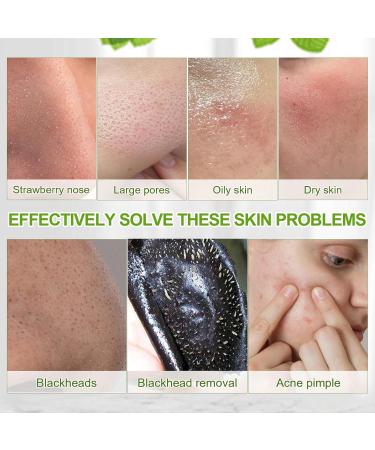 Blackhead Remover Mask - Charcoal Peel Off Face Mask for Pore Cleansing & Skin Care 100g | Unisex Blackhead Treatment - Buy Online on SooperMarket.com