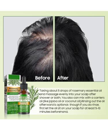 100% Pure Natural Rosemary Oil - Multipurpose Hair Oil for Growth Nourishing Scalp & Strengthening Hair - Buy Online on SooperMarket.com