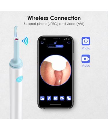 Earify Ear Wax Removal Kit with Camera and Light - Ear Wax Cleaner for Adults & Kids (White) - Buy Online on SooperMarket.com