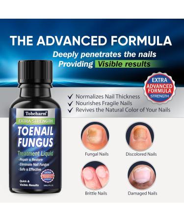 Extra Strength Toe Fungus Nail Treatment - Anti Fungal Care for Toenails & Fingernails - Buy Online on SooperMarket.com